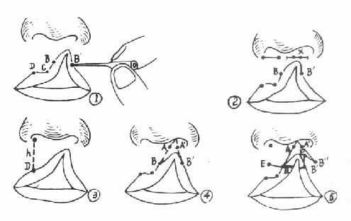 �����޸����������