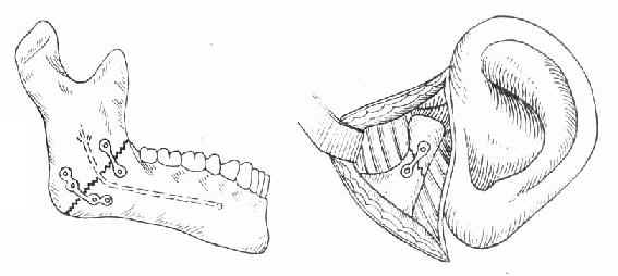 С�ְ��΢�͸ְ�̶���