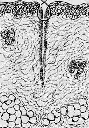 ����ϣ���Ե�Ժϣ���֢��Ӧ��