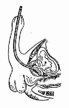 �в��˵���