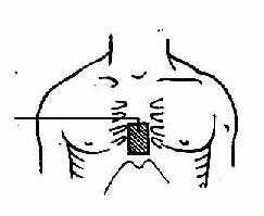 �������ఴѹ��ȷ��λ