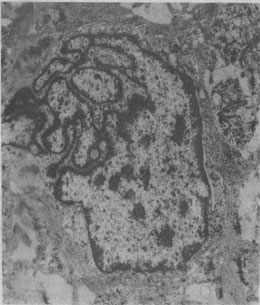 ������<a href=