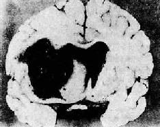 ��Ѫѹ��֮��<a href=