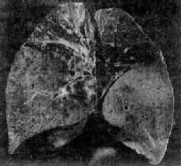 ��Ҷ�Է���