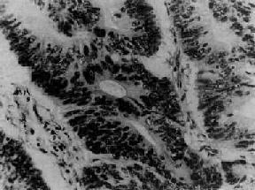 �ѳ�ճҺ������<a href=