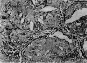 ǰ����<a href=