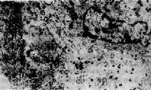 ������ϸ����<a href=