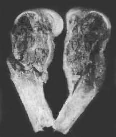 �Ǿ�ϸ��<a href=